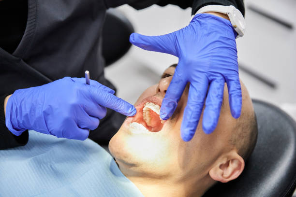 Best Broken Tooth Emergency  in Brooktrails, CA
